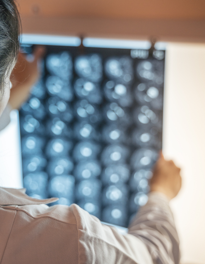 Surgeon checking x-ray